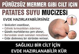 Patates Suyunun Mucizevi Faydalari Cilt Bakimi Saglik Dogal Cilt