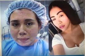 Yina calderon fajas de yeso. La Tuvo Que Borrar Yina Calderon Subio Foto De Su Antes Y Despues Y No Soporto Reacciones Protagonista