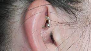 When cleaning your ears, make sure to wash your hands with soap and water before touching your how long does a piercing take to heal? Infected Ear Piercing Symptoms Treatment And Prevention