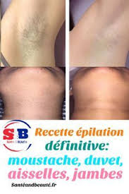 Recette Epilation Definitive Moustache Duvet Aisselles Jambes En 2020 Epilation Definitive Epilation Epilation Moustache