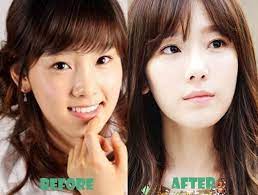 Little child that is like pack sol � ge snack * nama panggilan lain. Pin On Celebrity Surgery