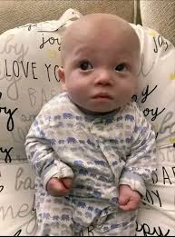 My son, John Hart, was diagnosed with COVID a few weeks ago. The day after  he was diagnosed, he coded at home. He went without a pulse for almost 40  minutes.