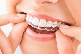 Typical orthodontic treatment comprises of metal braces on both arches for 24 months. Cost Of Braces In India Snazzy Clear Aligners