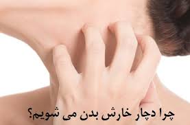 Image result for ‫دیابت  و خارش‬‎