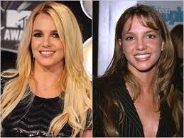 Pin On Before And After Celebrities
