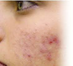 el ve ayaklar neden terler