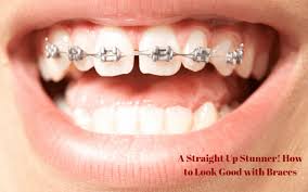 You don't have to be perfect. A Straight Up Stunner How To Look Good With Braces Life With Heidi