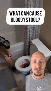 Image result for Blood in stool