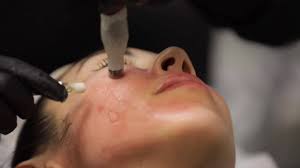 Skin perfect medical provides the most advanced aesthetic treatments and laser. Skin Perfect Medical Home Facebook