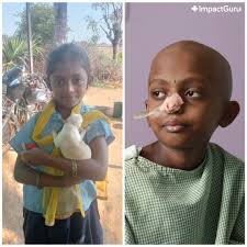 What started as a fever turned into a life-threatening diagnosis. 11 y/o  Bidushree is now fighting blood cancer, undergoing chemo after 15 blood  transfusions. Her parents, daily wage workers, are struggling to