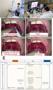 Clinical Application Of Intelligent Oropharyngeal Swab Robot Implication For Covid 19 Pandemic European Respiratory Society