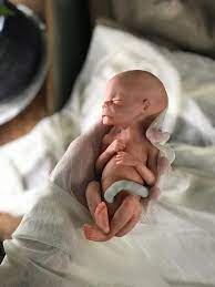 Pin Op Pregnancy