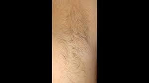 Underarm hair, as human body hair, usually starts to appear at the beginning of puberty, with growth usually completed by the end of the teenage years. Armpit Hair Growth In 30 Days Timelapse Youtube