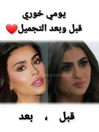 يومي_خوري #الجمال #قبل_بعد #التجميل #قبل_التجميل #بعد_التجميل #الماضي_الحاضر