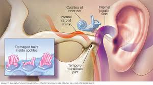 The neck is supplied by arteries other than the carotids. Https Www Stclair Org Services Mayo Clinic Health Information Diseases And Conditions Con 20118272