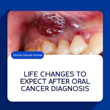Image result for dental cancer