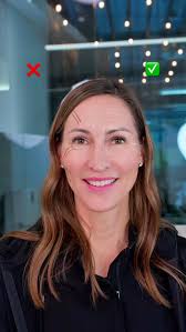 Just a heads-up, Botox isn’t going to fix all your wrinkles! , There are  basically two kinds of wrinkles: the ones that are always visible, which  are caused by collagen loss (static wrinkles), , And ...