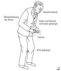 In diesem fall sollten sie mit ihrem arzt besprechen, ob sie das betreffende medikament weiter einnehmen müssen oder ob es sich eventuell absetzen oder durch ein besser verträgliches. Https Online Medunigraz At Mug Online Wbabs Getdocument Pthesisnr 47573 Pautornr Porgnr 1