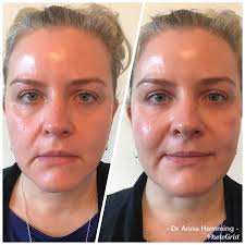 She is the founder of anna medical . Dr Anna Hemming In Twickenham