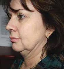 Stop grabbing public land!