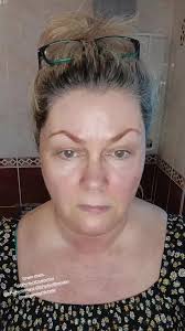 Michelle Colon Amputee