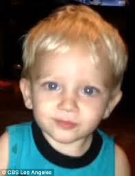 Toddler left with facial injuries after being mauled by Labrador at  California park