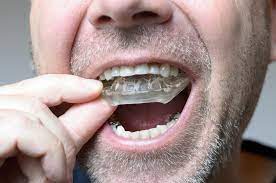 Analisa teknikal pergerakan harga intraday pasangan mata uang utama gbp/usd senin 14 juni 2021. Orthodontics Maloccclusion Other Problems And Starting Treatment