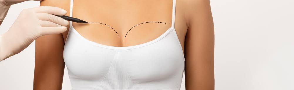 Breast Lift Surgery in Dubai - DCS