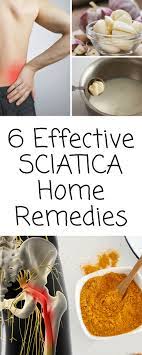 Pin On Sciatica Treatment