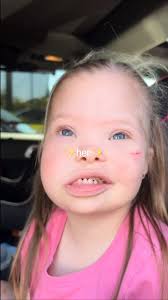 October is ✨Down syndrome awareness month✨, This month is about spreading  ACCEPTANCE , but also about celebrating ✨her✨ — and everyone like her — for  the beautiful, unique light they bring into the ...