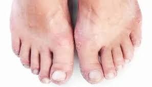 Image result for Beau lines feet