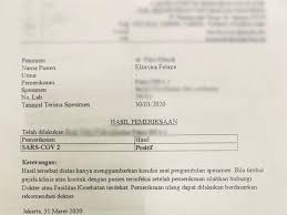 Seri Penyintas Covid 19 Tiga Bulan Bergumul Dengan Covid 19 Kawalcovid19