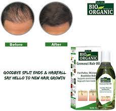 However, argan oil is an effective treatment of causes of temporary hair ultimately, argan oil is a great supplement to a hair loss treatment regime for these reasons. Buy Herbal Hair Regrowth Oil Hair Oil Hair Growth Regrowth Treatment Anti Hair Fall Solution Online 185 From Shopclues