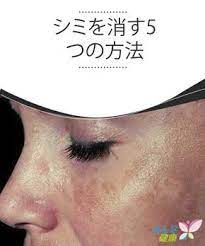シミやホクロに効く 5つの自家製トリートメント みんな健康 顔 シミ 消す 顔のシミ 美容