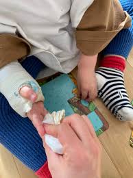 ギプス 汚れ 落とし 方