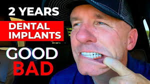 The GOOD and BAD Of My Dental Implants After 2 Years