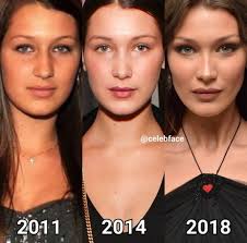 There's breathtaking, and then there's bella hadid wearing a lung necklace on the cannes film festival red carpet. Bella Hadid Atozplasticsurgery