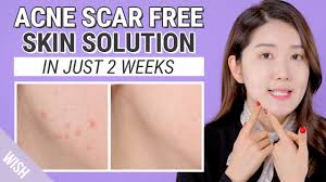 These help protect the wound from infection while the new skin develops. 5 Step Skin Care For Acne Scar Treatment With 3 Key Ingredients