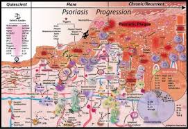 Full Text Current Knowledge On Psoriasis And Autoimmune