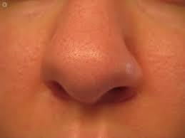 It was the best money i have ever spent. What If I M Not Happy With My Nose Job
