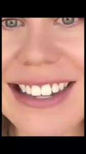 Misconceptions About Glasgow Accents