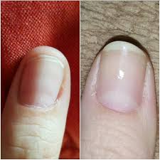 Results After 2 Months Opi Nail Envy Nail Strengthener