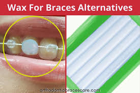 Dry off the braces with a tissue before you start the process of wax application. What To Use Instead Of Wax For Braces 5 Alternatives Orthodontic Braces Care
