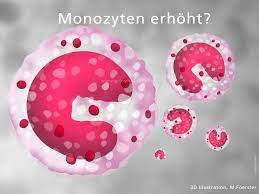 Monozyten Zu Hoch Bedeutung Der Werte Monozytose Dr Stephan