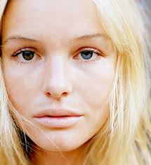 Heterochromia I Ve Got Something Like This My Eyes Are Blue But The Right One Has A Br Kate Bosworth Eyes Different Colored Eyes Two Different Colored Eyes