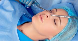 Remodelarea nasului fara operatie este la moda peste tot in lume findca nu are riscurile asocate cu o rinoplastie si practic nu aveti nimic de pierdut! Dr Cristian NiÈescu Blog De Chirurgie EsteticÄ