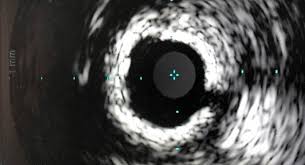 Iliescu bucurești scoate la concurs urmatoarele posturi: Cardiologie IntervenÈ›ionalÄƒ CautÄƒ SÄƒnÄƒtate