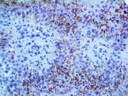 Image result for Treponema