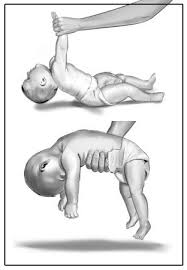 Image result for Floppy Infant