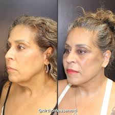 Dr. John Thomassen Plastic Surgery (@drthomassenmd) · Fort Lauderdale, FL